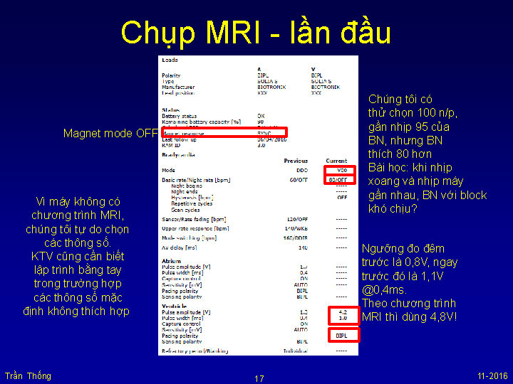 VNHRS2016 Chup MRI