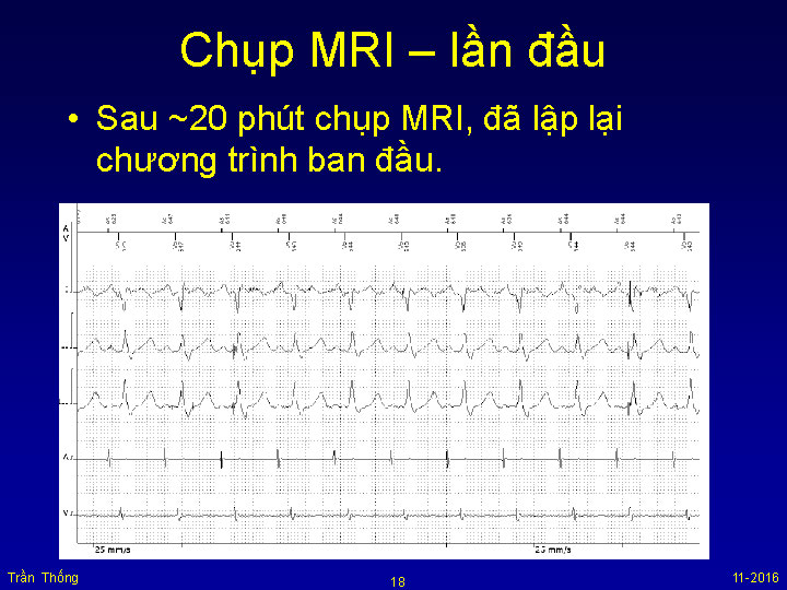 VNHRS2016 Chup MRI