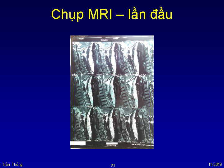 VNHRS2016 Chup MRI