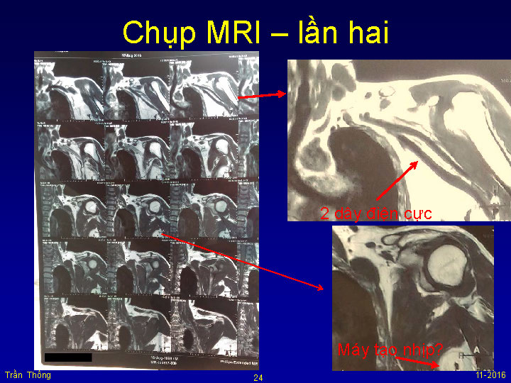 VNHRS2016 Chup MRI