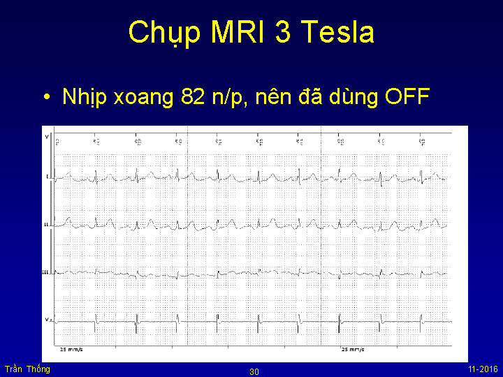 VNHRS2016 Chup MRI