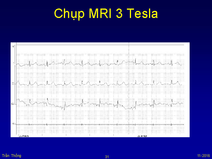 VNHRS2016 Chup MRI