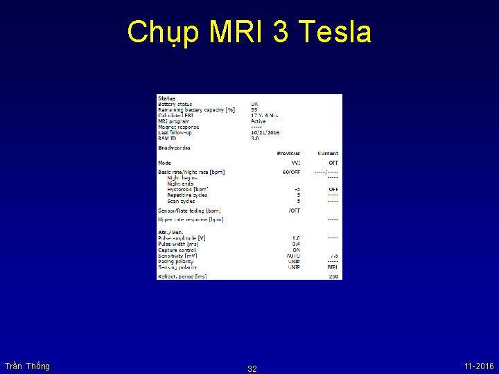 VNHRS2016 Chup MRI