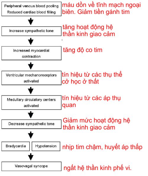 VV syncope