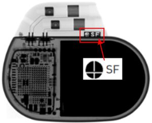X-ray ID
